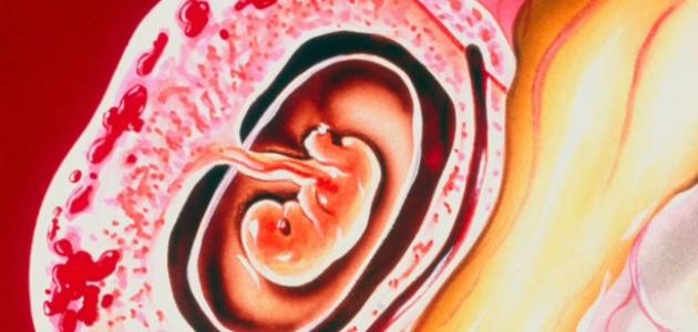 صورة جديد ما هو علاج الحمل خارج الرحم