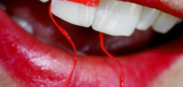 صورة جديد طريقة سريعة لتبيض الاسنان