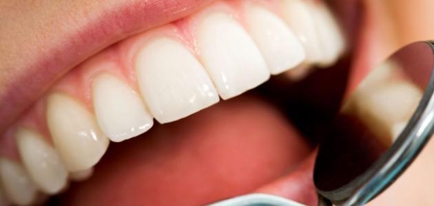603e485065301 جديد كيفية إزالة التسوس من الأسنان طبيعياً