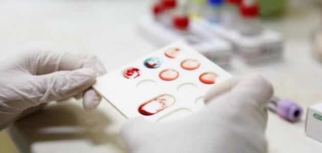 صورة جديد طريقة معرفة فصيلة الدم