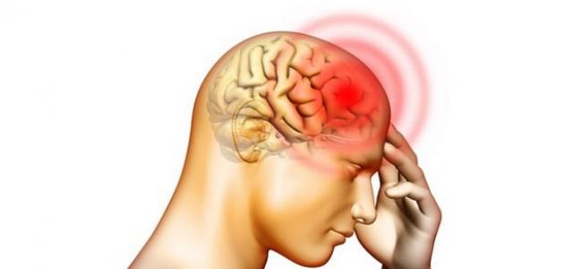 صورة جديد ما هي أعراض جلطة الدماغ