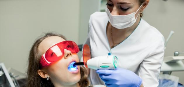 60580e2312f7a جديد فوائد وأضرار تبييض الأسنان بالليزر