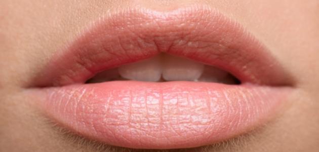 صورة جديد علاج السواد حول الفم