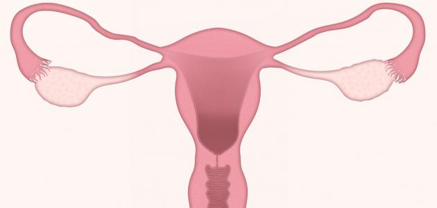 صورة جديد أضرار ربط الرحم لمنع الحمل