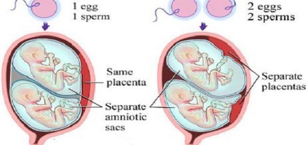 صورة مراحل نمو التوائم في بطن الأم