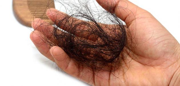 صورة كيفية التخلص من تساقط الشعر عند البنات