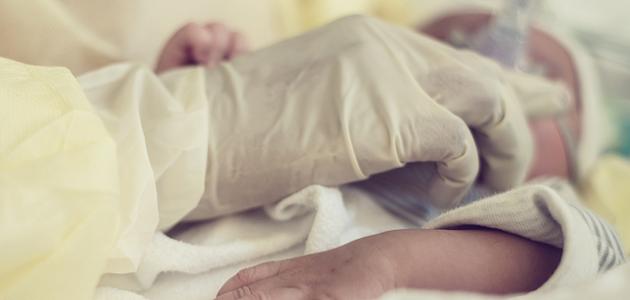 صورة من أهم أعراض مرض الثلاسيميا على الطفل الرضيع