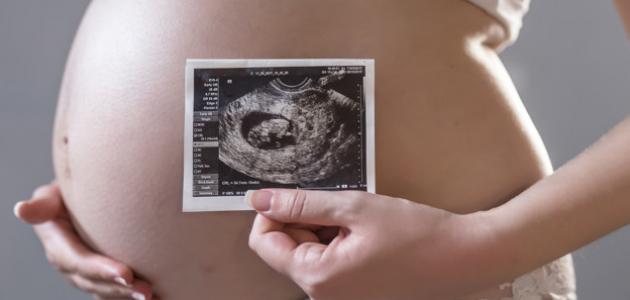 صورة زيادة حركة الجنين في الشهر التاسع