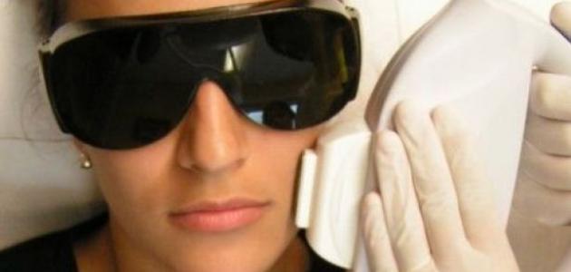 آثار الليزر على الوجه آثار الليزر على الوجه