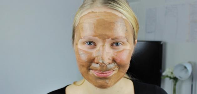 آثار حب الشباب وعلاجها السريع آثار حب الشباب وعلاجها السريع