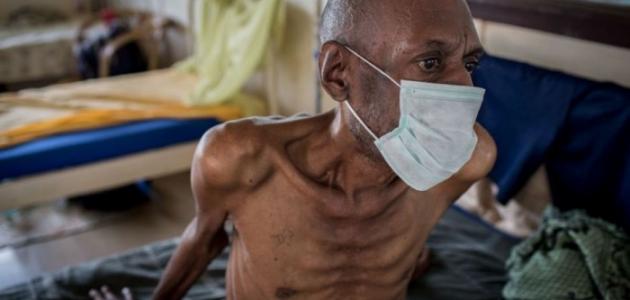 أخطر أمراض العالم أخطر أمراض العالم