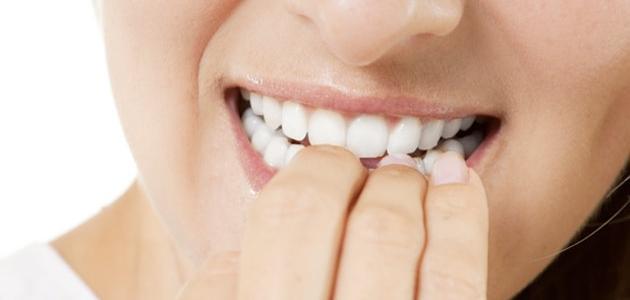 أسباب أكل الأظافر