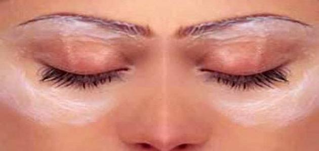 أسباب السواد حول العين أسباب السواد حول العين