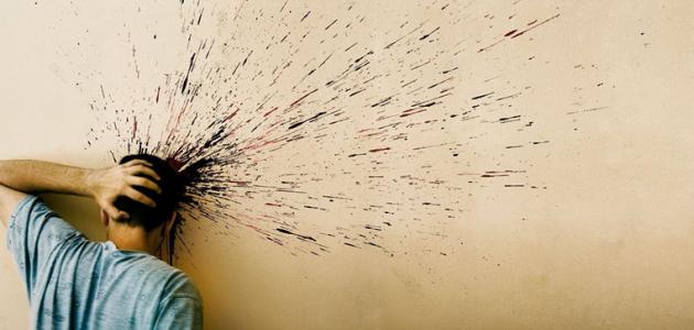 أسباب الصداع العنقودي أسباب الصداع العنقودي