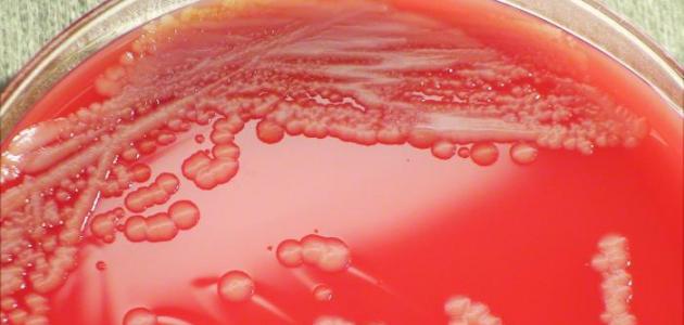 أسباب بكتيريا الدم أسباب بكتيريا الدم