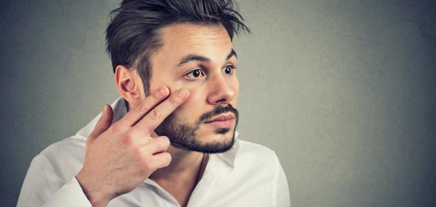 أسباب ضباب العين أسباب ضباب العين