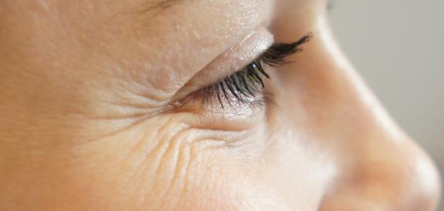 أسباب ظهور تجاعيد الوجه أسباب ظهور تجاعيد الوجه