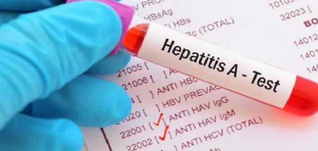 أسباب فيروس الكبد أسباب فيروس الكبد