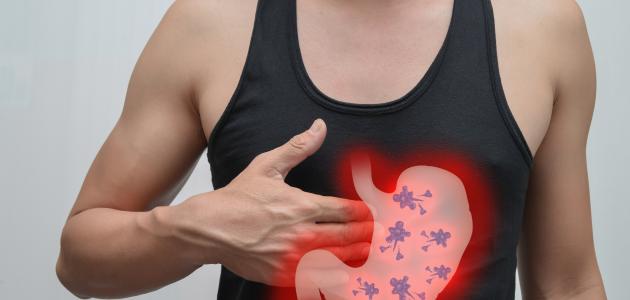 أسباب مرض جرثومة المعدة