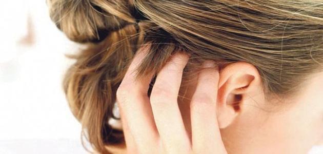 أسباب وجع فروة الرأس