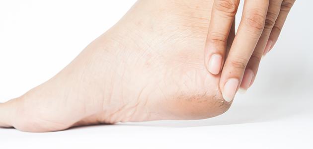 أسرع طريقة لتنعيم القدمين أسرع طريقة لتنعيم القدمين