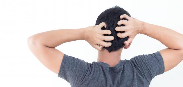 أضرار حك فروة الرأس أضرار حك فروة الرأس