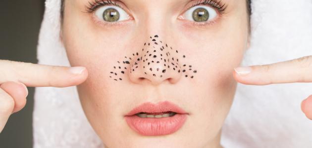 أضرار لصقات إزالة الرؤوس السوداء