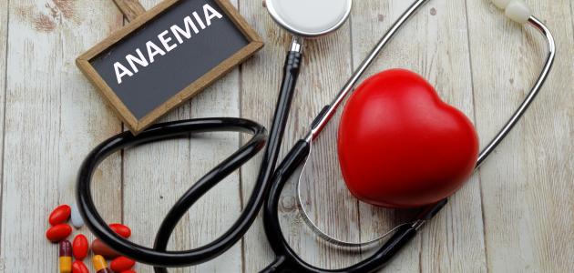 أطعمة تسبب فقر الدم أطعمة تسبب فقر الدم