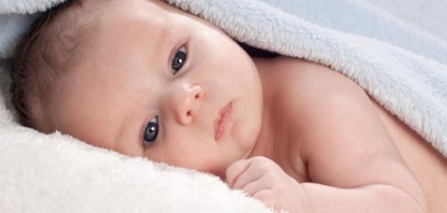 أعراض أبو صفار للأطفال أعراض أبو صفار للأطفال