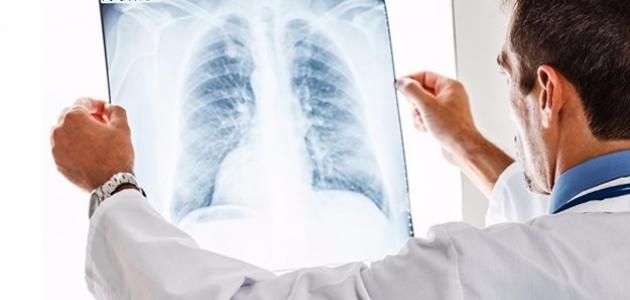 أعراض الثقب في الرئة أعراض الثقب في الرئة