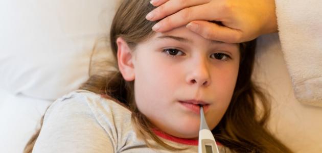أعراض الحمى أعراض الحمى