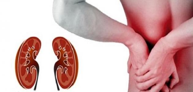 أعراض الفشل الكلوي وأسبابه أعراض الفشل الكلوي وأسبابه