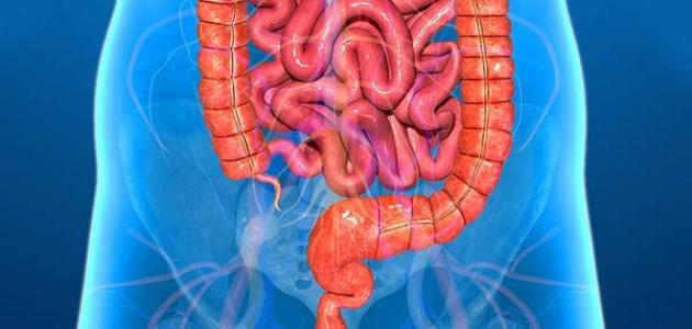 أعراض القولون التقرحي أعراض القولون التقرحي