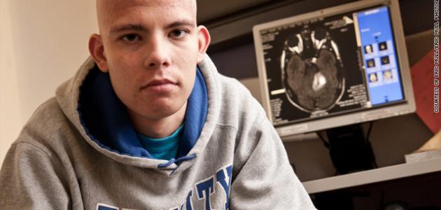 أعراض صداع الأورام أعراض صداع الأورام