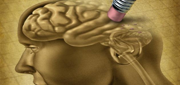 أعراض ضمور المخ أعراض ضمور المخ