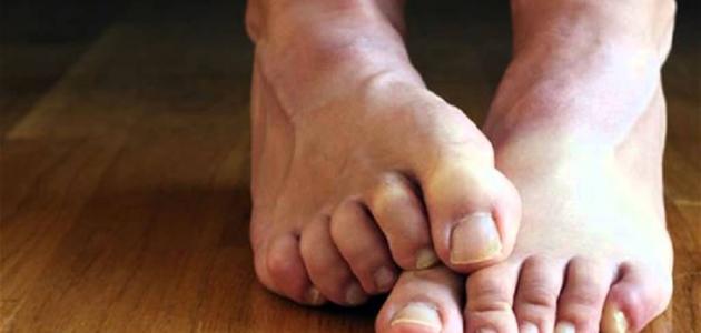 أعراض نقص المغنيسيوم والبوتاسيوم أعراض نقص المغنيسيوم والبوتاسيوم