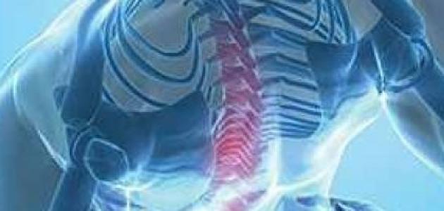 أعراض هشاشة العظام وعلاجها أعراض هشاشة العظام وعلاجها