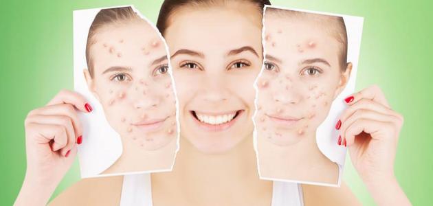 أقنعة لتبييض البشرة الدهنية أقنعة لتبييض البشرة الدهنية