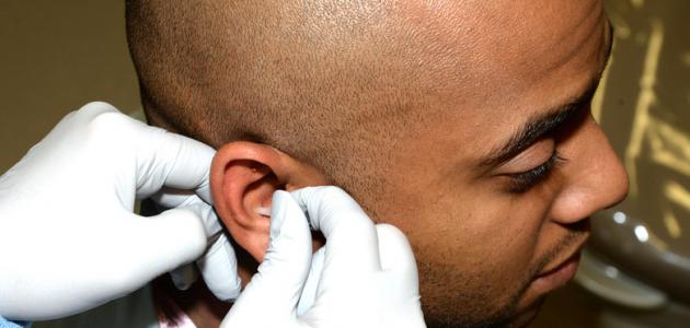 ألم وطنين الأذن ألم وطنين الأذن