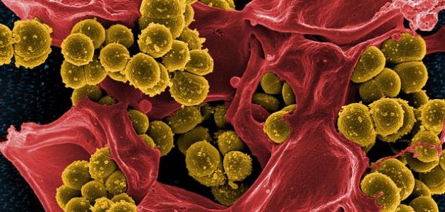 أمراض كريات الدم البيضاء أمراض كريات الدم البيضاء