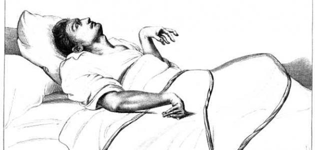 أنواع الصرع أنواع الصرع