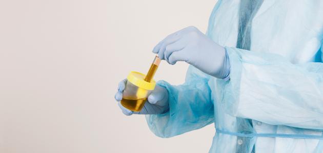 أنواع بكتيريا المسالك البولية أنواع بكتيريا المسالك البولية