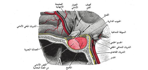 أورام الغدة النخامية أورام الغدة النخامية