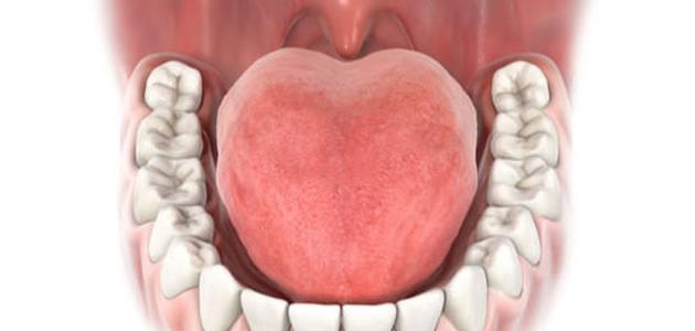 أورام اللسان
