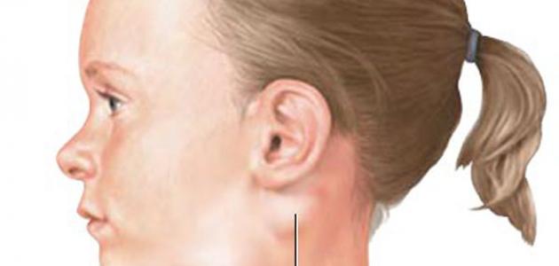 أين توجد الغدد اللمفاوية في الجسم أين توجد الغدد اللمفاوية في الجسم