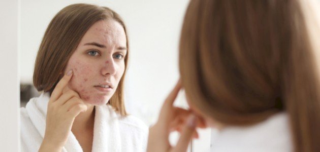 إزالة آثار حب الشباب والبقع الغامقة ببساطة إزالة آثار حب الشباب والبقع الغامقة ببساطة