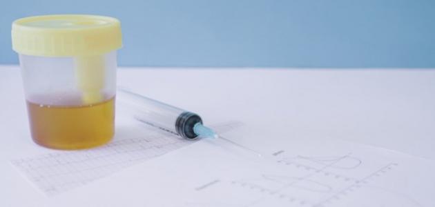 ارتفاع حمض البول ارتفاع حمض البول