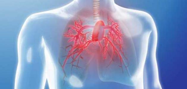 ارتفاع ضغط الدم الرئوي ارتفاع ضغط الدم الرئوي