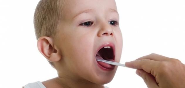 استئصال اللوزتين عند الأطفال استئصال اللوزتين عند الأطفال