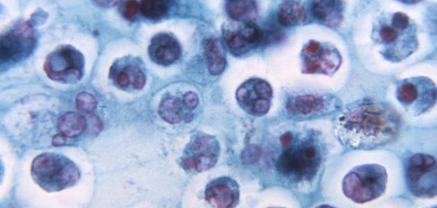 اسم كريات الدم البيضاء اسم كريات الدم البيضاء